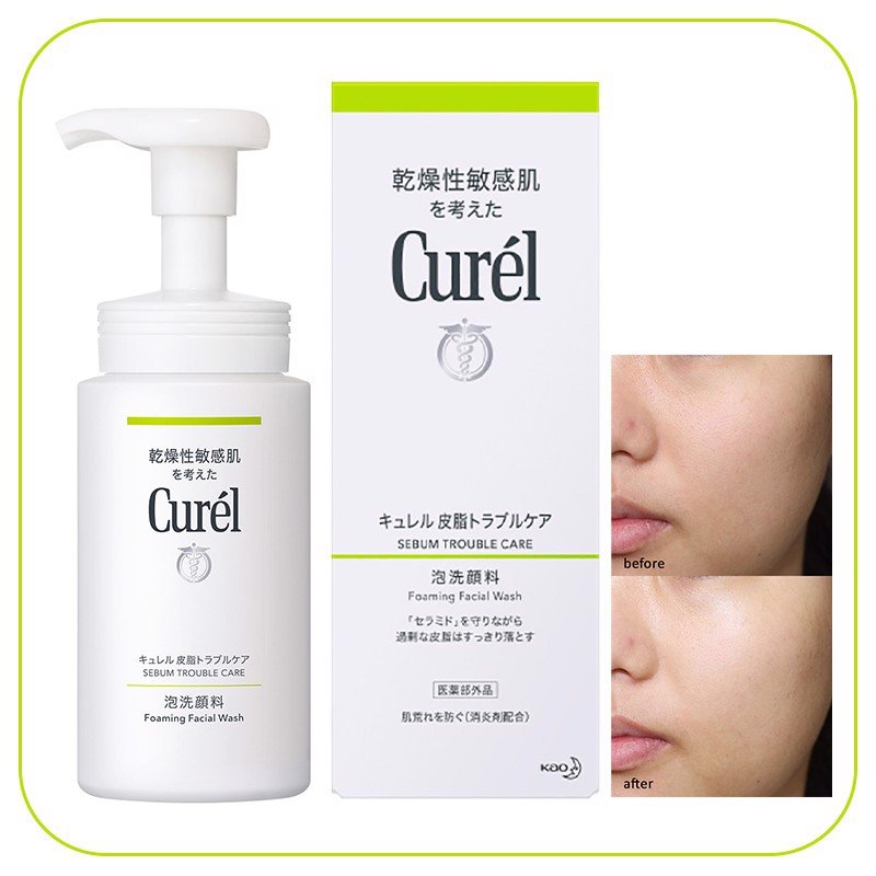 Curél Intensive Moisture Care Foaming Wash giúp làn da được giảm thiểu kích ứng gây ra bởi lượng dầu thừa, bã nhờn